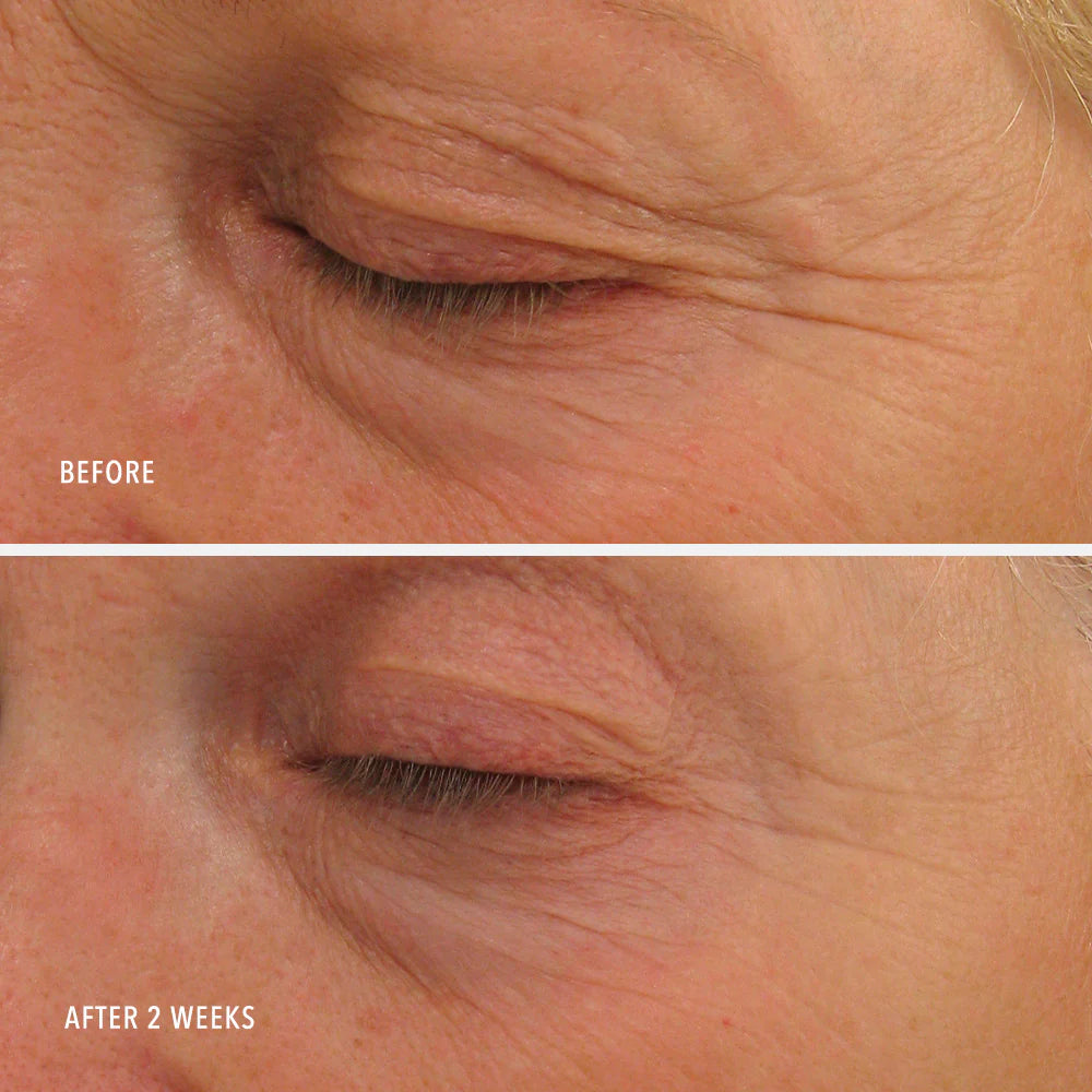 Eye Authority Peptide Eye Cream